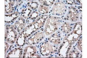 Immunohistochemical staining of paraffin-embedded Human prostate tissue using anti-PFN1 mouse monoclonal antibody.