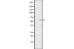 Western blot analysis of Phospho-PKM2 (Tyr105) using K562 whole cell lysates (PKM antibody  (pTyr105))