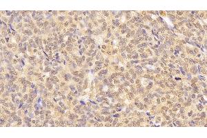 Immunohistochemistry (IHC) image for anti-Lamin B1 (LMNB1) (AA 52-233) antibody (ABIN7428965)