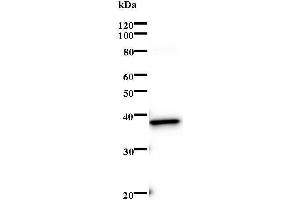 Western Blotting (WB) image for anti-SRY (Sex Determining Region Y)-Box 4 (SOX4) antibody (ABIN932199) (SOX4 antibody)