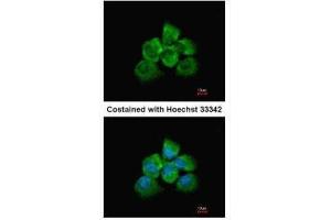 ICC/IF Image Immunofluorescence analysis of methanol-fixed A431, using ARHGEF18, antibody at 1:200 dilution. (ARHGEF18 antibody  (Center))