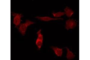 ABIN6276687 staining HUVEC by IF/ICC. (FSHR antibody  (Internal Region))
