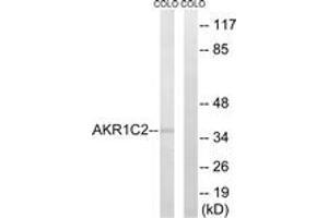 Western blot analysis of extracts from COLO cells, using AKR1C2 Antibody. (AKR1C2 antibody  (AA 21-70))