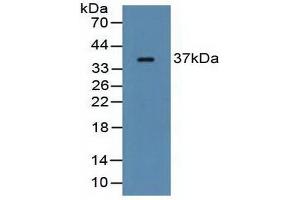 Detection of FCN1 in Rat Serum using Polyclonal Antibody to Ficolin 1 (FCN1)