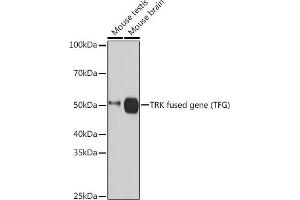 Western blot analysis of extracts of various cell lines, using TRK fused gene (TFG) (TFG) Rabbit mAb (ABIN1512690, ABIN3022090, ABIN3022091 and ABIN7101442) at 1:3000 dilution. (TFG antibody)