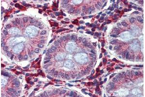 Colon, Human: Formalin-Fixed, Paraffin-Embedded (FFPE) (IGFBP4 antibody  (AA 180-229))