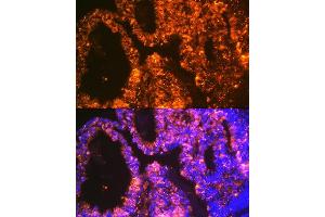 Immunofluorescence analysis of human ovary using Lin28 Rabbit mAb (ABIN7268266) at dilution of 1:100 (40x lens). (LIN28A antibody)