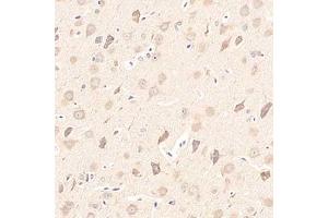 Immunohistochemistry analysis of paraffin-embedded rat brain using,Girdin (ABIN7073539) at dilution of 1: 1500 (Girdin antibody)