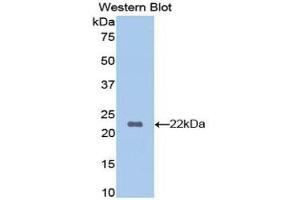 Western Blotting (WB) image for anti-Hemoglobin beta (HBB) (AA 1-147) antibody (ABIN1175987) (Hemoglobin Subunit beta antibody  (AA 1-147))
