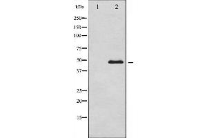 Western blot analysis of GATA3 phosphorylation expression in HeLa whole cell lysates,The lane on the left is treated with the antigen-specific peptide.