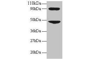 Western blot All lanes: CCL7 antibody at 2 μg/mL + 293T whole cell lysate Secondary Goat polyclonal to rabbit IgG at 1/15000 dilution Predicted band size: 12 kDa Observed band size: 48, 90 kDa (CCL7 antibody  (AA 24-99))
