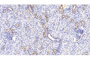 Detection of NOG in Human Kidney Tissue using Polyclonal Antibody to Noggin (NOG) (NOG antibody  (AA 28-232))