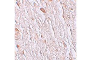 Immunohistochemical staining of human brain cells with SLC39A7 polyclonal antibody  at 2.
