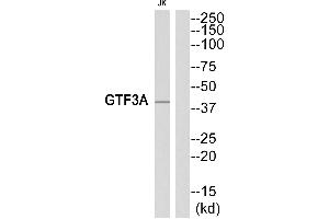 Western blot analysis of extracts from Jurkat cells, using GTF3A antibody. (GTF3A antibody  (Internal Region))