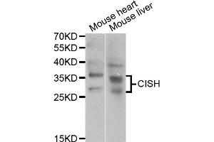 Western blot analysis of extracts of various cell lines, using CISH antibody (ABIN5973711) at 1/1000 dilution.