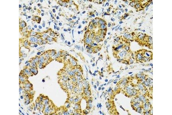 HSPA9 antibody