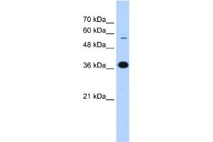Western Blotting (WB) image for anti-Prolyl 4-Hydroxylase, beta Polypeptide (P4HB) (N-Term) antibody (ABIN2783245)