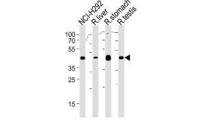 Western Blotting (WB) image for anti-Polycomb Group Ring Finger 6 (PCGF6) antibody (ABIN3000530) (PCGF6 antibody)