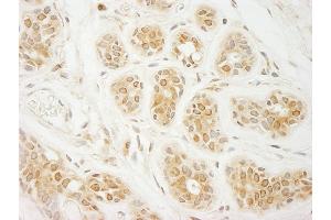 Immunohistochemistry (IHC) image for anti-Eukaryotic Translation Initiation Factor 2A, 65kDa (EIF2A) (AA 525-575) antibody (ABIN7453862) (EIF2A antibody  (AA 525-575))