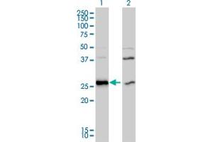 Western Blot analysis of DNAJB6 expression in transfected 293T cell line by DNAJB6 monoclonal antibody (M01), clone 2C11-C1.