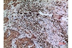 Immunohistochemistry (IHC) image for anti-Calcyclin Binding Protein (CACYBP) (C-Term) antibody (ABIN3187896)