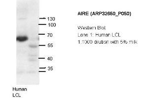 Image no. 2 for anti-Autoimmune Regulator (AIRE) (N-Term) antibody (ABIN2779777) (AIRE antibody  (N-Term))