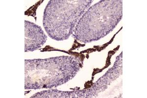 IHC testing of FFPE mouse testis tissue with Cyp17a1 antibody at 2ug/ml. (CYP17A1 antibody  (AA 80-363))