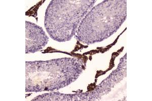 IHC testing of FFPE mouse testis tissue with Cyp17a1 antibody at 2ug/ml.