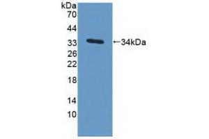 Detection of Recombinant MAPRE1, Human using Polyclonal Antibody to Microtubule Associated Protein RP/EB Family, Member 1 (MAPRE1) (MAPRE1 antibody  (AA 2-268))