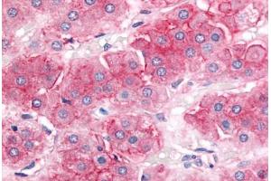 Human Adrenal, Cortex (formalin-fixed, paraffin-embedded) stained with ABCB1 antibody ABIN213616 at 20 ug/ml followed by biotinylated goat anti-rabbit IgG secondary antibody ABIN481713, alkaline phosphatase-streptavidin and chromogen. (ABCB1 antibody  (Cytoplasmic Domain))