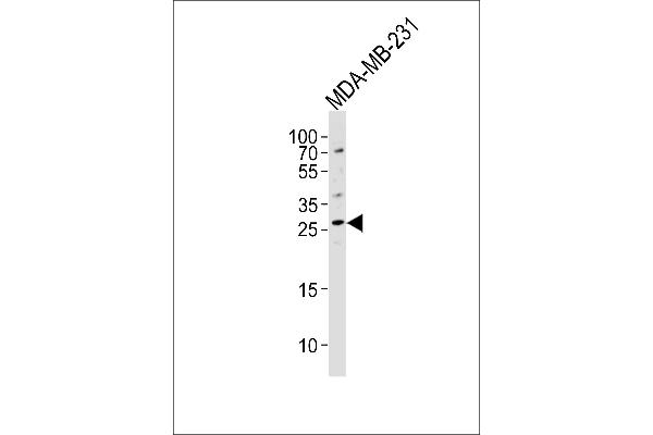 CRISP1 antibody  (C-Term)