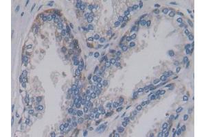 Used in DAB staining on fromalin fixed paraffin-embedded Liver tissue (PCSK9 antibody  (AA 156-461))