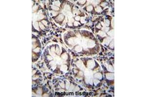 Immunohistochemistry (Paraffin-embedded Sections) (IHC (p)) image for anti-Calcium Channel, Voltage-Dependent, gamma Subunit 8 (CACNG8) (AA 97-127), (N-Term) antibody (ABIN950998)