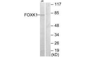 Western blot analysis of extracts from Jurkat cells, using FOXK1 antibody. (Foxk1 antibody  (C-Term))