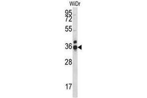 CCDC90B Antibody (Center) western blot analysis in WiDr cell line lysates (35µg/lane). (CCDC90B antibody  (Middle Region))