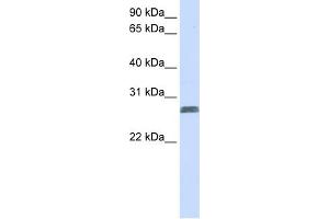 WB Suggested Anti-TMEM51 Antibody Titration:  0.