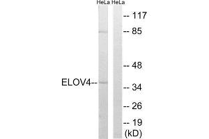 Western Blotting (WB) image for anti-ELOVL Fatty Acid Elongase 4 (ELOVL4) (Internal Region) antibody (ABIN1851294)