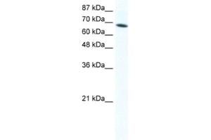 Western Blotting (WB) image for anti-DEAD (Asp-Glu-Ala-Asp) Box Polypeptide 1 (DDX1) antibody (ABIN2461580) (DDX1 antibody)