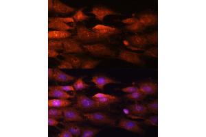 Immunofluorescence analysis of C6 cells using N-WASP/WASL Polyclonal Antibody (ABIN3016273, ABIN3016274, ABIN3016275, ABIN1683282 and ABIN6219682) at dilution of 1:100 (40x lens).