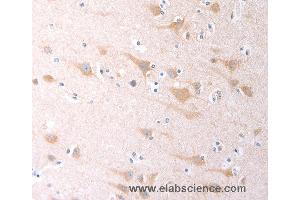 Immunohistochemistry of Human brain using SCGB1A1 Polyclonal Antibody at dilution of 1:60