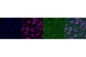 Immunohistochemistry (IHC) image for anti-Ubiquitin Carboxyl-terminal Esterase L1 (Ubiquitin Thiolesterase) (UCHL1) antibody (ABIN7456011)