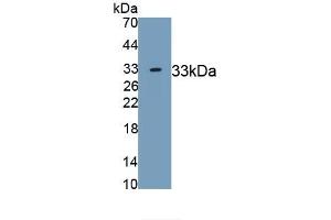 Detection of Recombinant MYH4, Human using Monoclonal Antibody to Laminin Alpha 3 (LAMa3) (LAMA3 antibody  (AA 47-296))