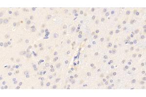 Detection of CYPA in Rat Cerebrum Tissue using Polyclonal Antibody to Cyclophilin A (CYPA) (PPIA antibody  (AA 2-164))