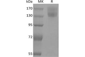 Leptin Receptor Protein (LEPR) (mFc Tag)