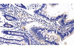 Immunohistochemistry (IHC) image for anti-alpha-Glucosidase (AGLU) (AA 213-392) antibody (ABIN7431452)