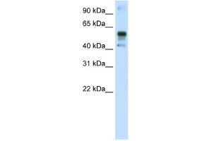 WB Suggested Anti-NFE2L2 Antibody Titration:  1. (NRF2 antibody  (C-Term))