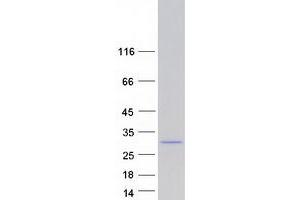 Rab5c Protein (Transcript Variant 1) (Myc-DYKDDDDK Tag)