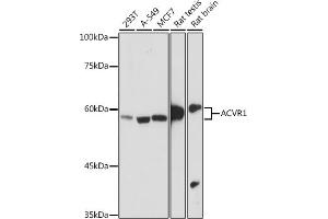 Western blot analysis of extracts of various cell lines, using  antibody (ABIN7265415) at 1:1000 dilution. (ACVR1 antibody)