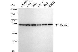 Western blotting analysis using Radixin antibody (ABIN7800123). (Recombinant Radixin antibody)