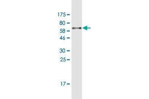 Western Blot detection against Immunogen (55. (Activator of Basal Transcription 1 antibody  (AA 1-272))